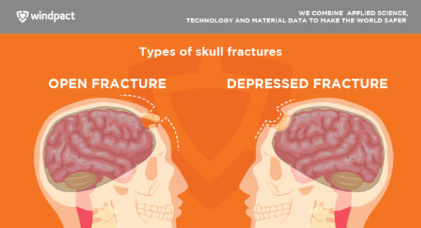 types of skull fracture